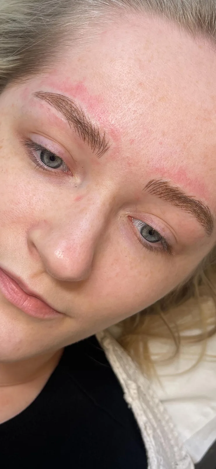 Close-up of microbladed brows immediately after treatment