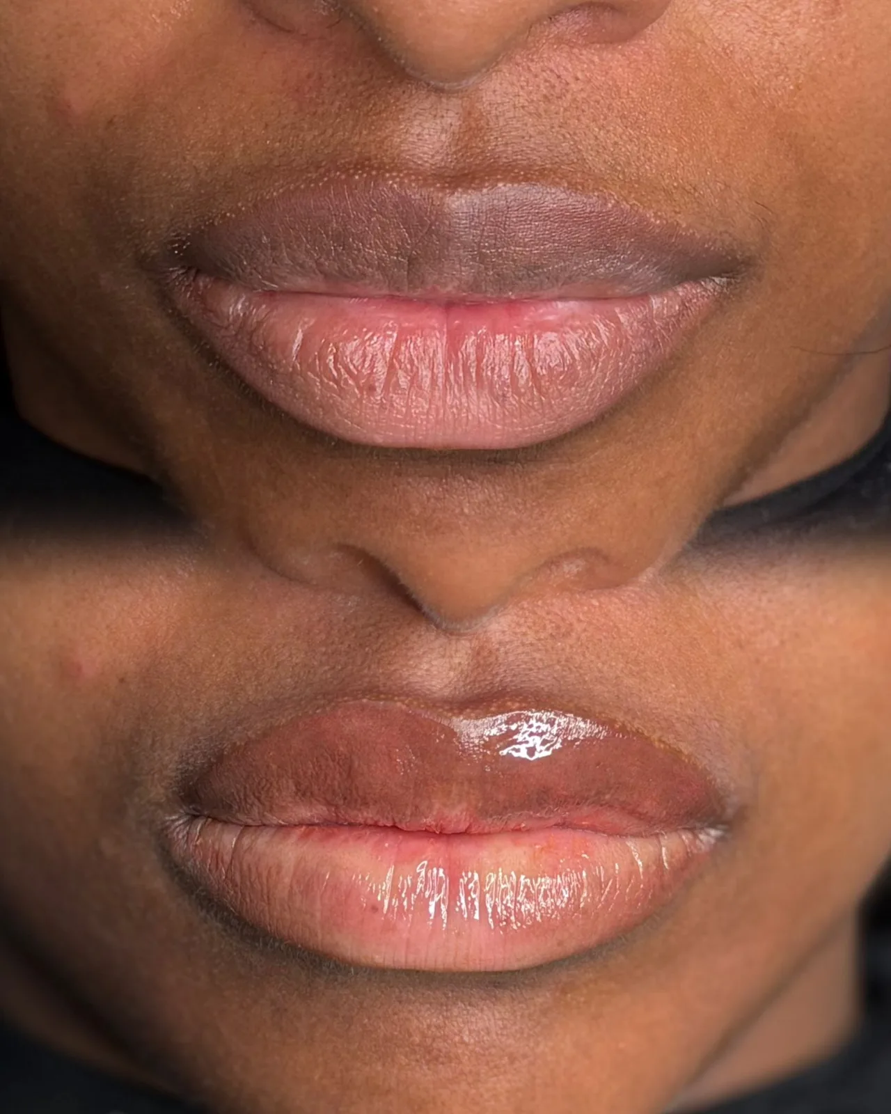 Lips before and after a lip blush treatment on deeper skin