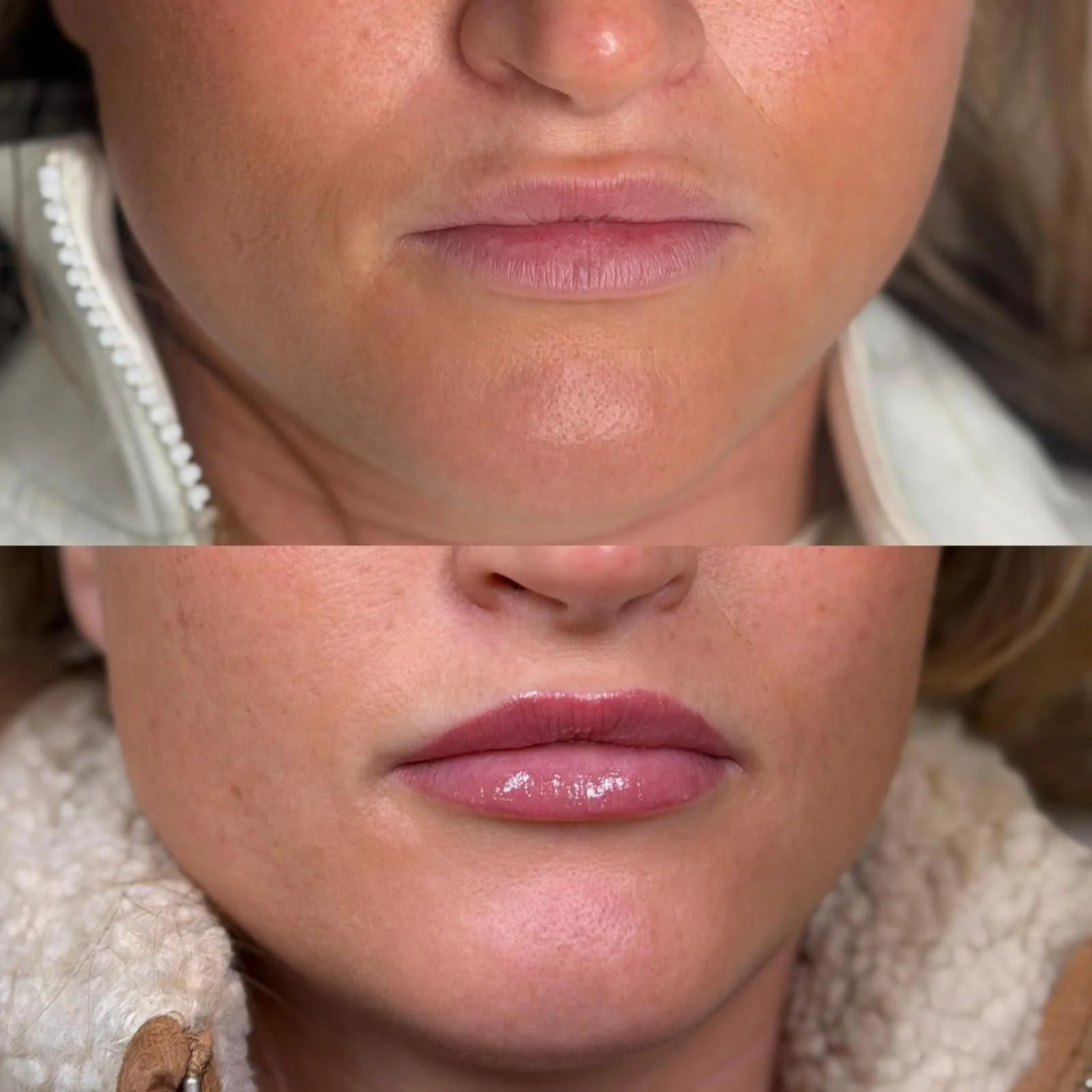 Lips before and after a lip blush treatment, showing added colour and definition