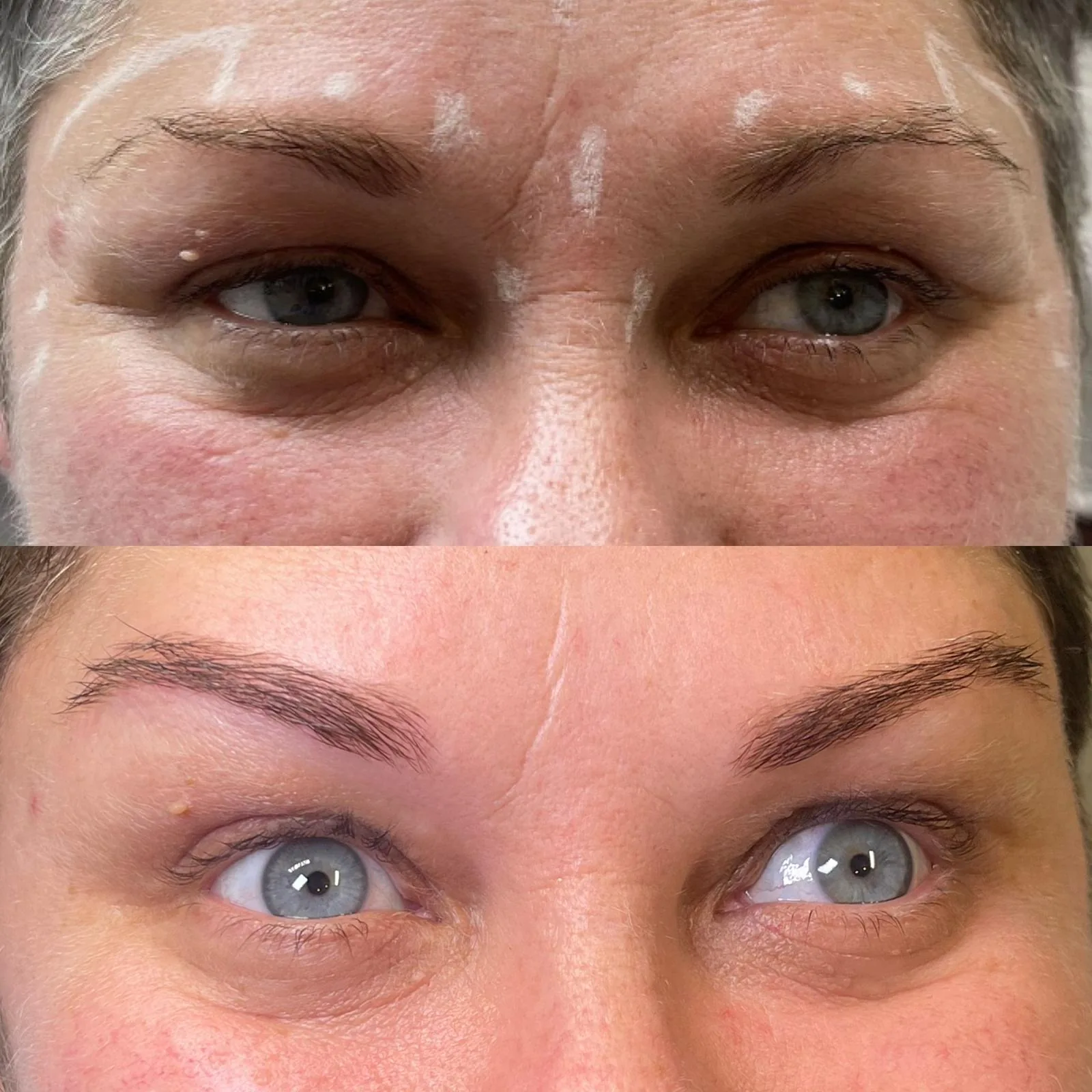 The eye area and brows before and after a course of skin treatment