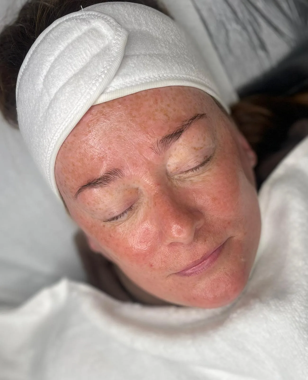 A client during a skin treatment at the Karrina Crystal clinic